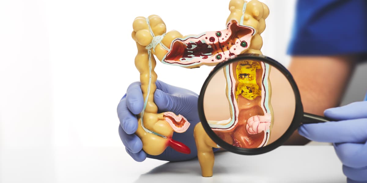 Colon hydrotherapy digestive wellness support