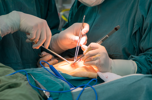 General surgery treatment and consultation