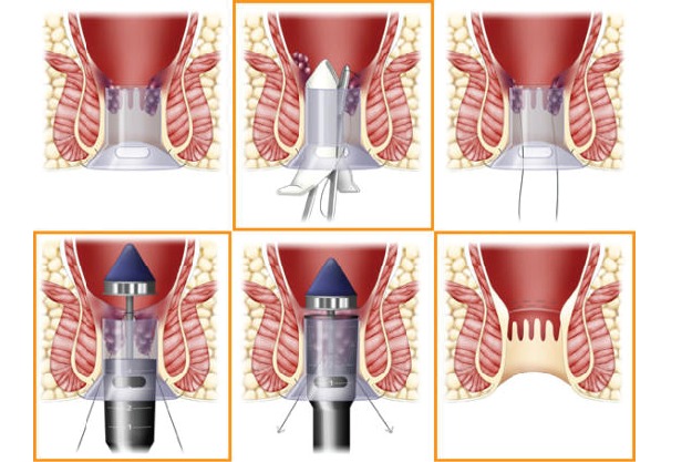 Advanced proctology and laser care